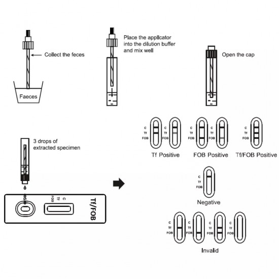 5 Bowel Cancer GP/Professional Colon Faecal Occult Blood FOB & Transferrin Tests