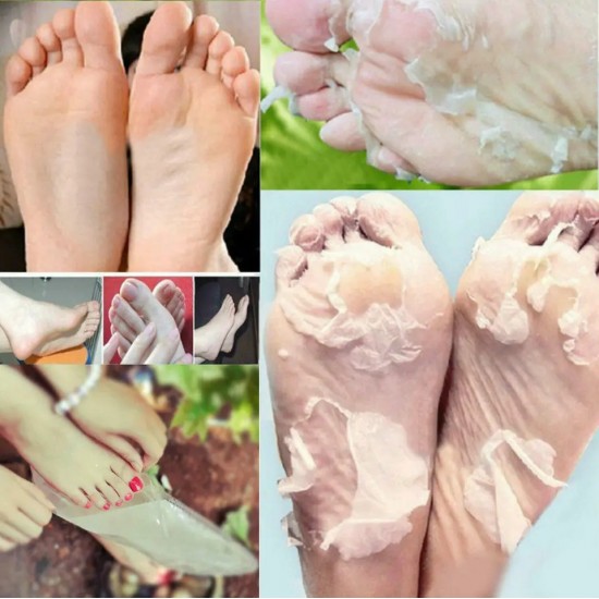 Exfoliating Foot Peel Mask