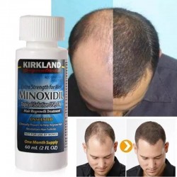 Kirkland Minoxidil 5% for hair loss - Extra Strength 60ml Kirkland Minoxidil 5% for hair loss - Extra Strength 60ml